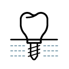 Dr Mehmet Oztel Bone Grafting