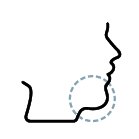 Dr Mehmet Oztel Genioplasty Chin Surgery