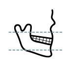 Dr Mehmet Oztel Orthognathic Surgery