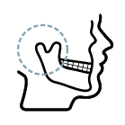 Dr Mehmet Oztel TMJ Surgery